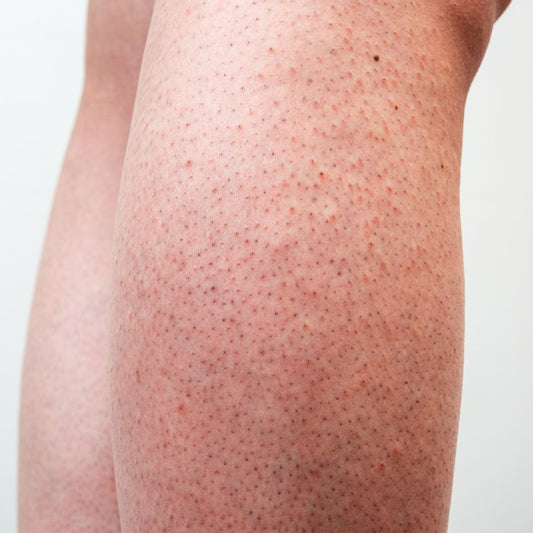 Erdbeerhaut nach der Rasur: Was wirklich hilft — und warum ein Luffa-Peeling der Gamechanger ist